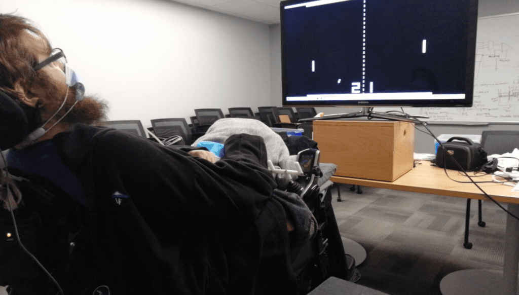 pong match with brain implant